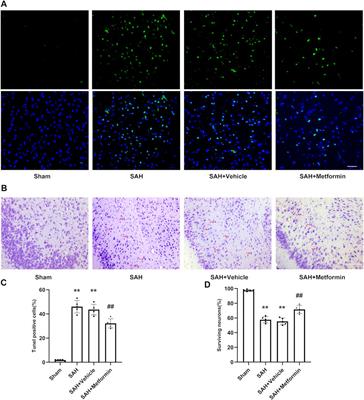 Metformin Inhibits NLR Family Pyrin Domain Containing 3 (NLRP)-Relevant Neuroinflammation via an Adenosine-5′-Monophosphate-Activated Protein Kinase (AMPK)-Dependent Pathway to Alleviate Early Brain Injury After Subarachnoid Hemorrhage in Mice